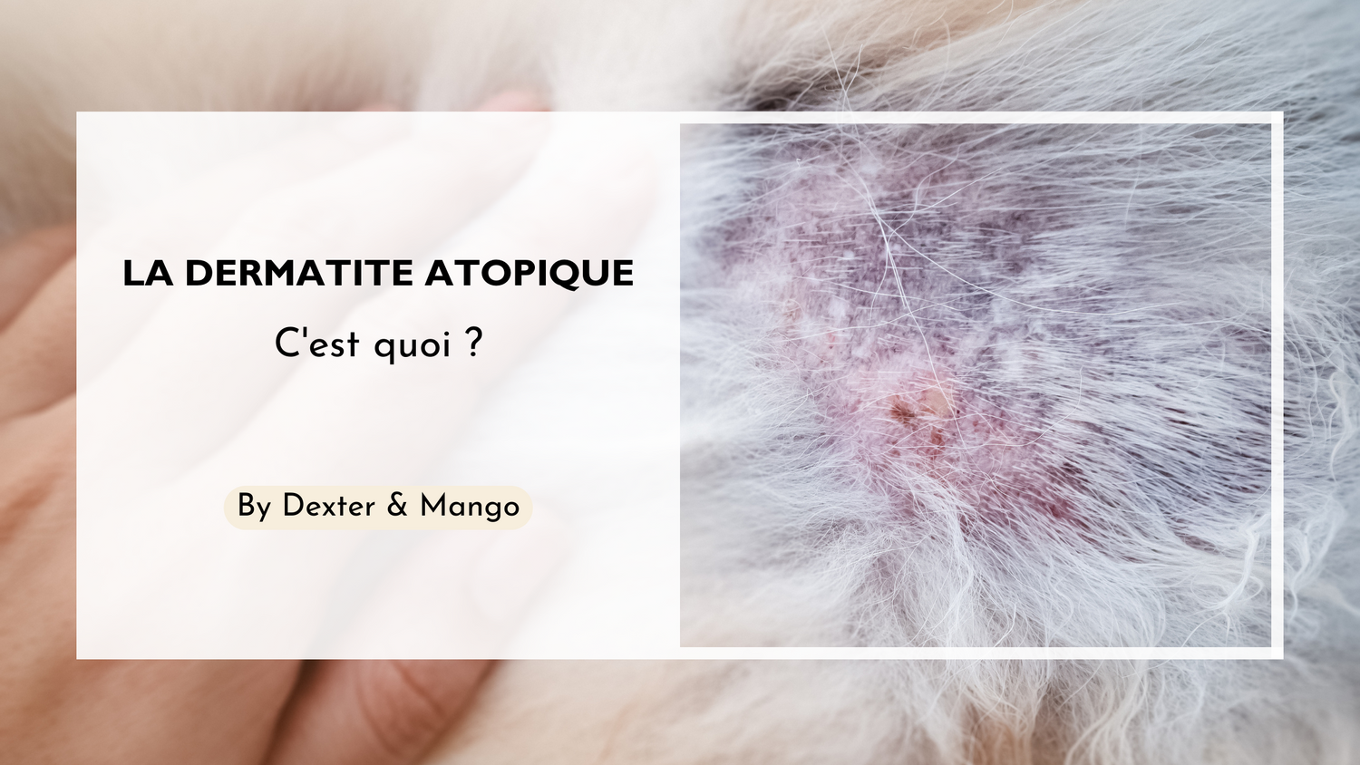 La dermatite atopique : Définition, symptômes et traitements
